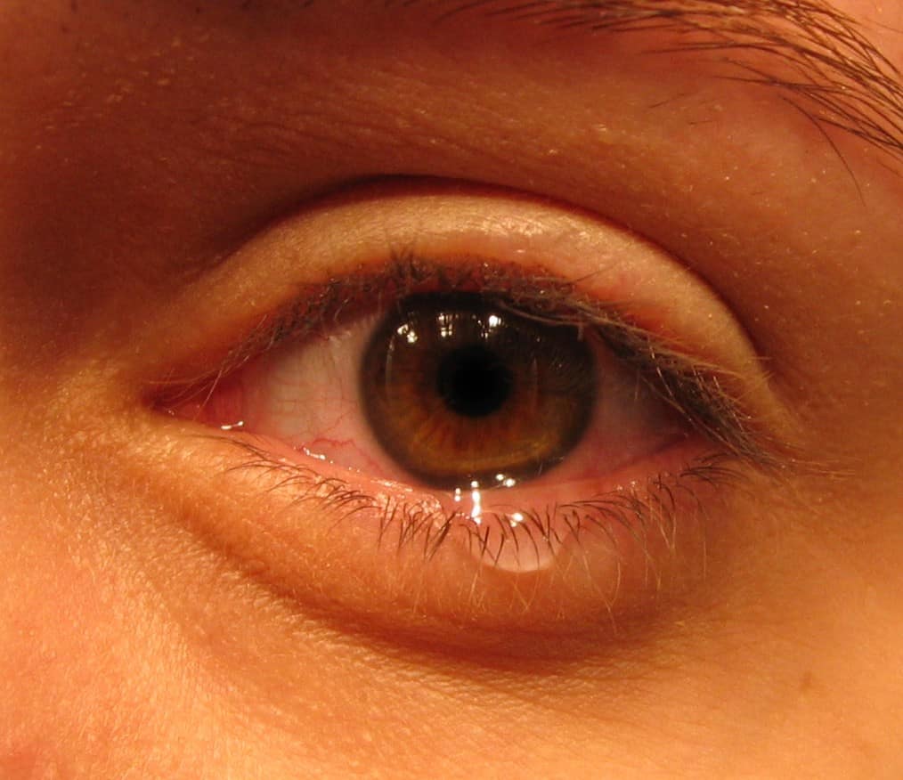 A lady's tear-filled eye