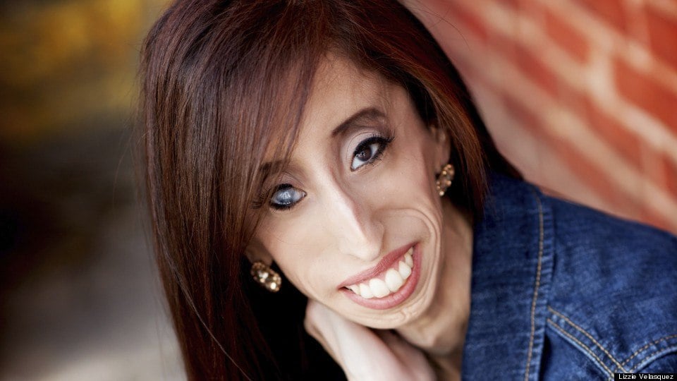 21 Lessons From Lizzie Velasquez, Who Is Actually Amazingly Beautiful