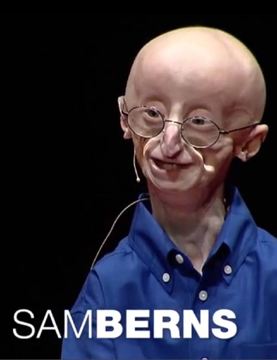This Kid With Progeria Has a Philosophy For a Happy Life That Will Absolutely Surprise, Astound, Inspire, and Make You Cry!