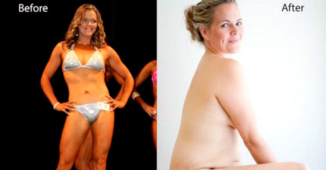 One Inspirational Woman’s Struggle To Love Her Body Could Change The World
