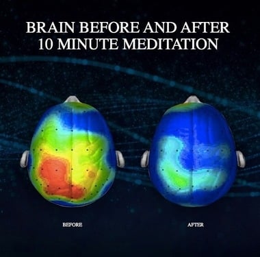 Brain on Meditation