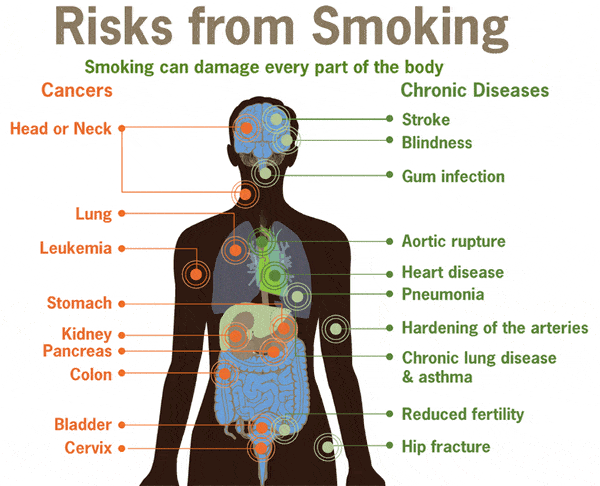 Smoking risks