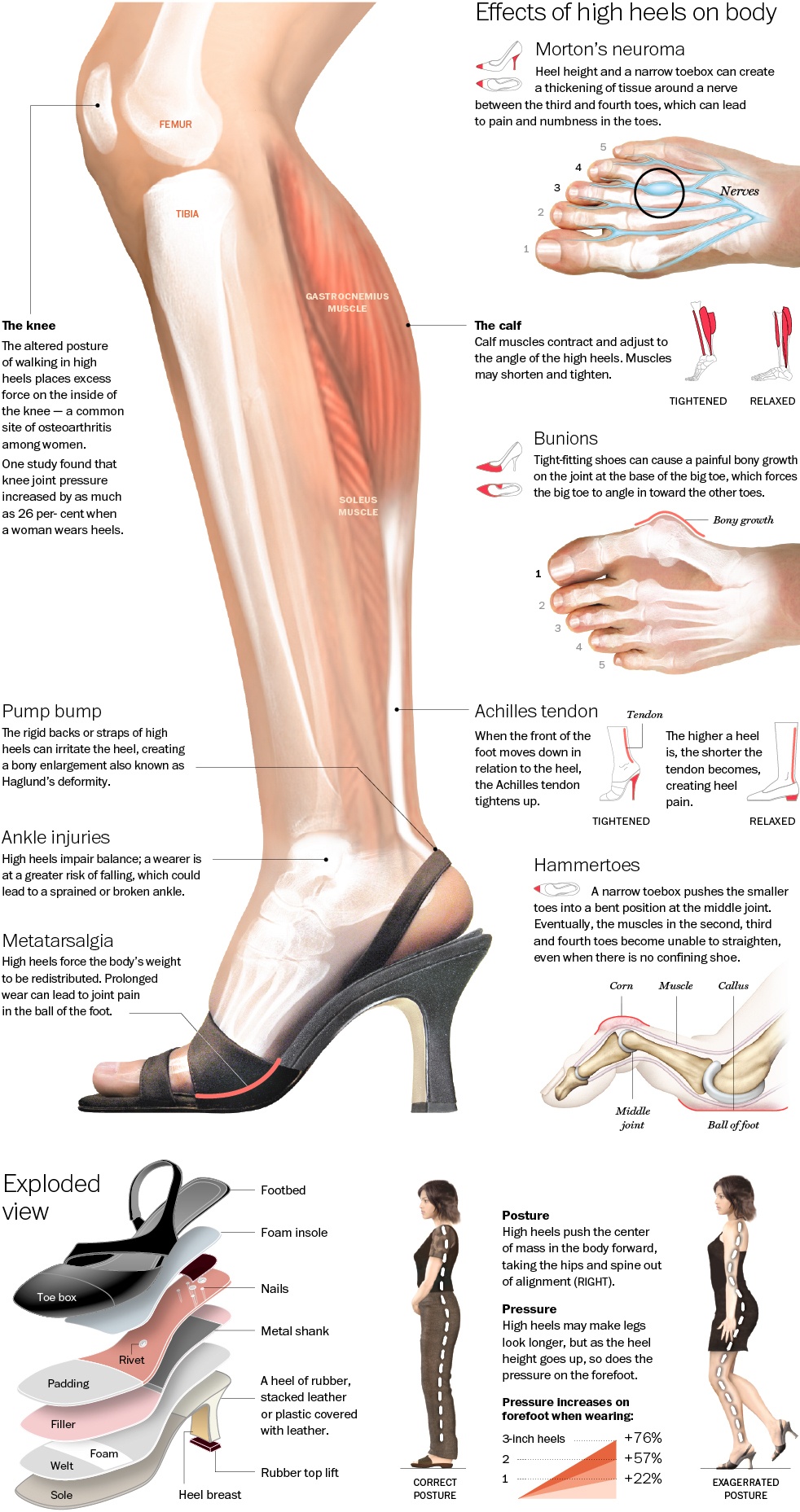 the-true-effect-of-high-heels