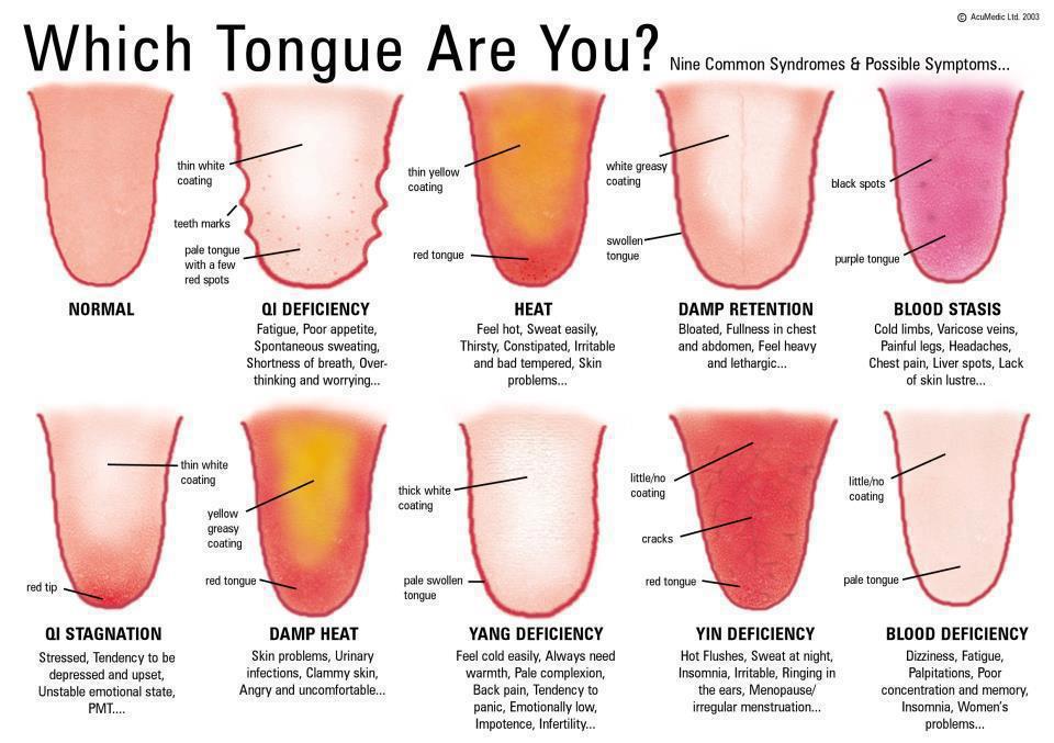 What Can Tongue Analysis Tell You About Your Health?
