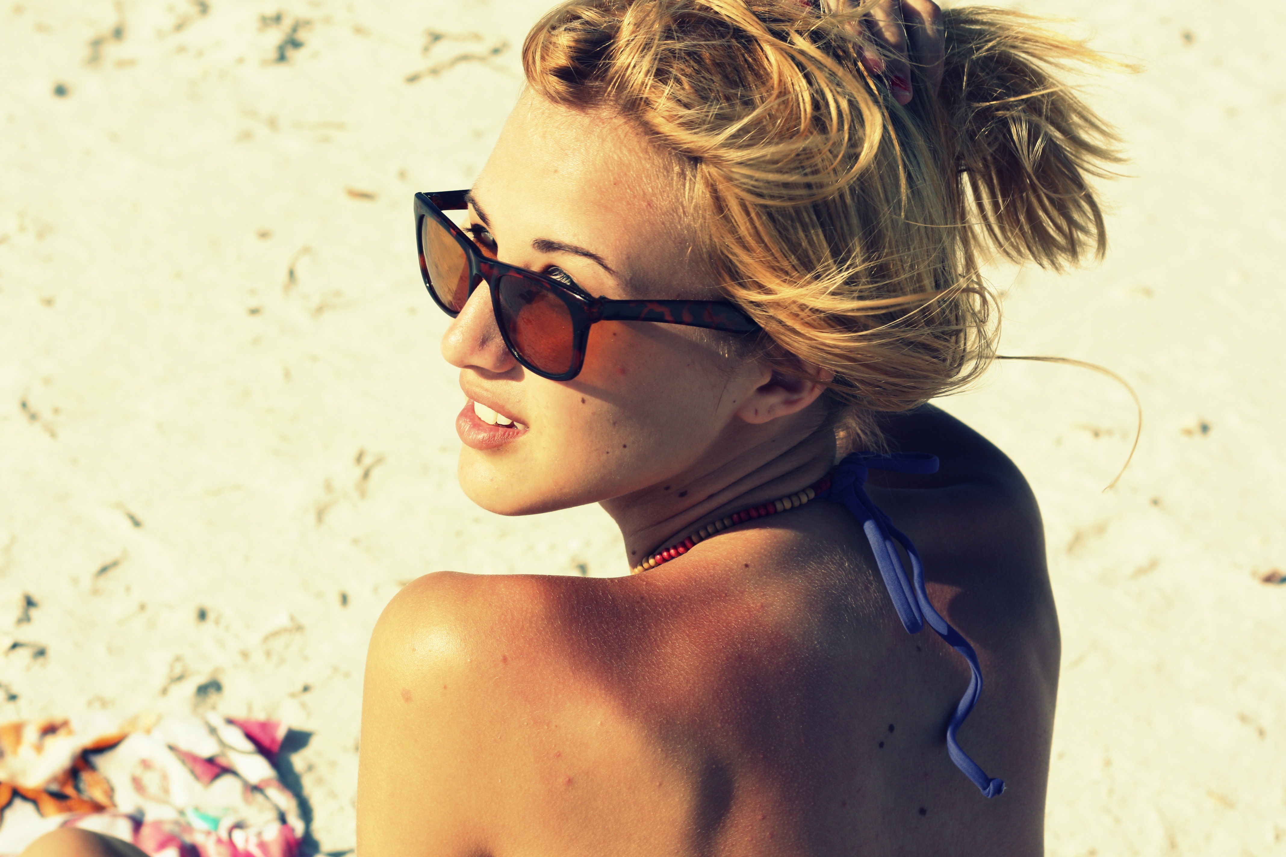 Getting Sunburned Is Much More Serious Than You Think, Here’s Why
