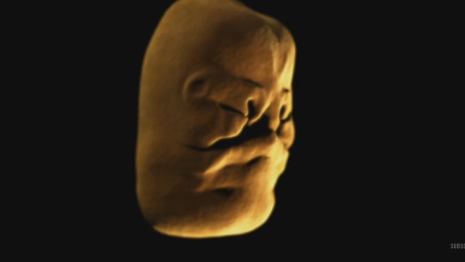 This Is How Baby Face Develops In The Womb