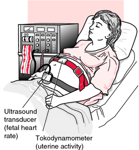 heart monitoring