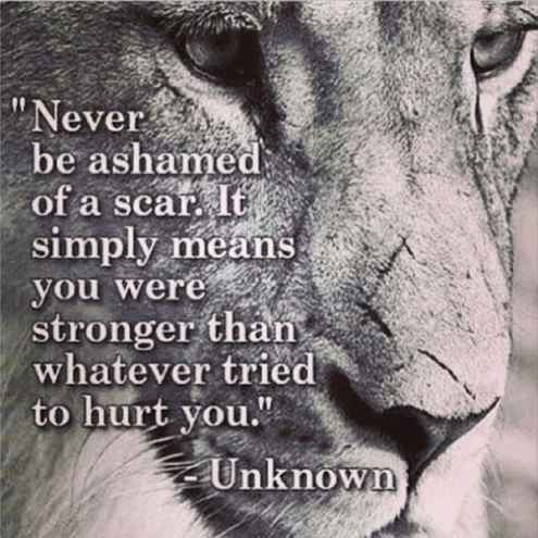 Never Be Ashamed Of A Scar - Stay Strong Quote