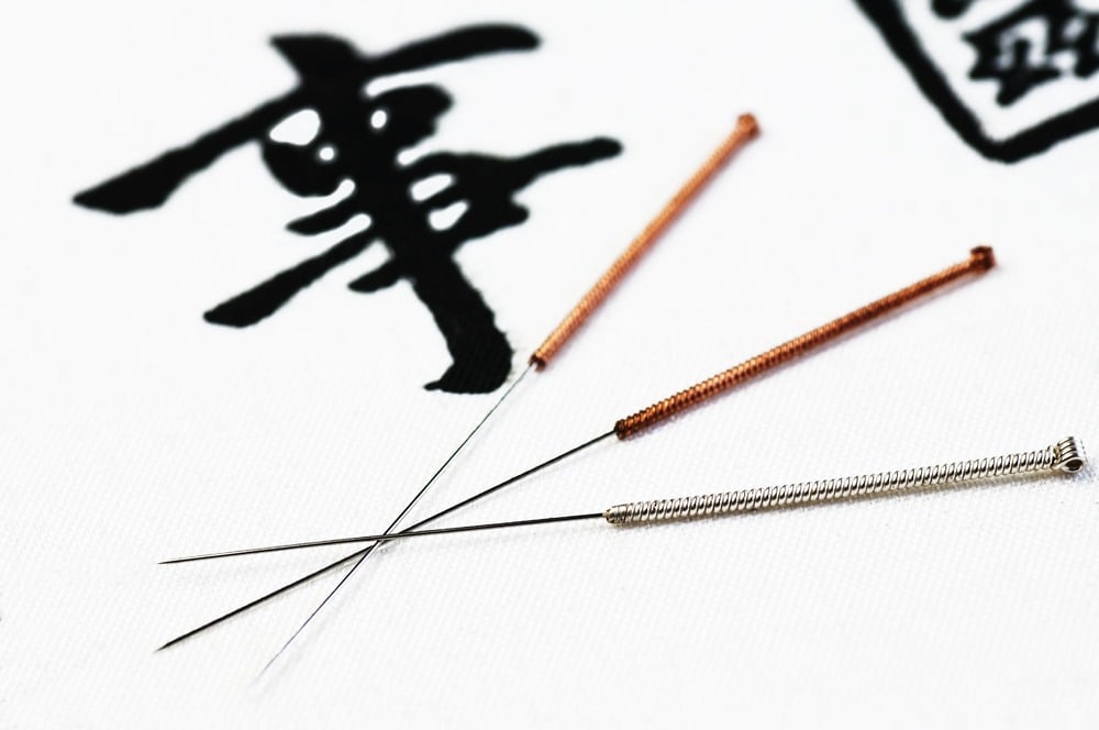 Acupuncture Found An Incredible Relief For Chronic Pain