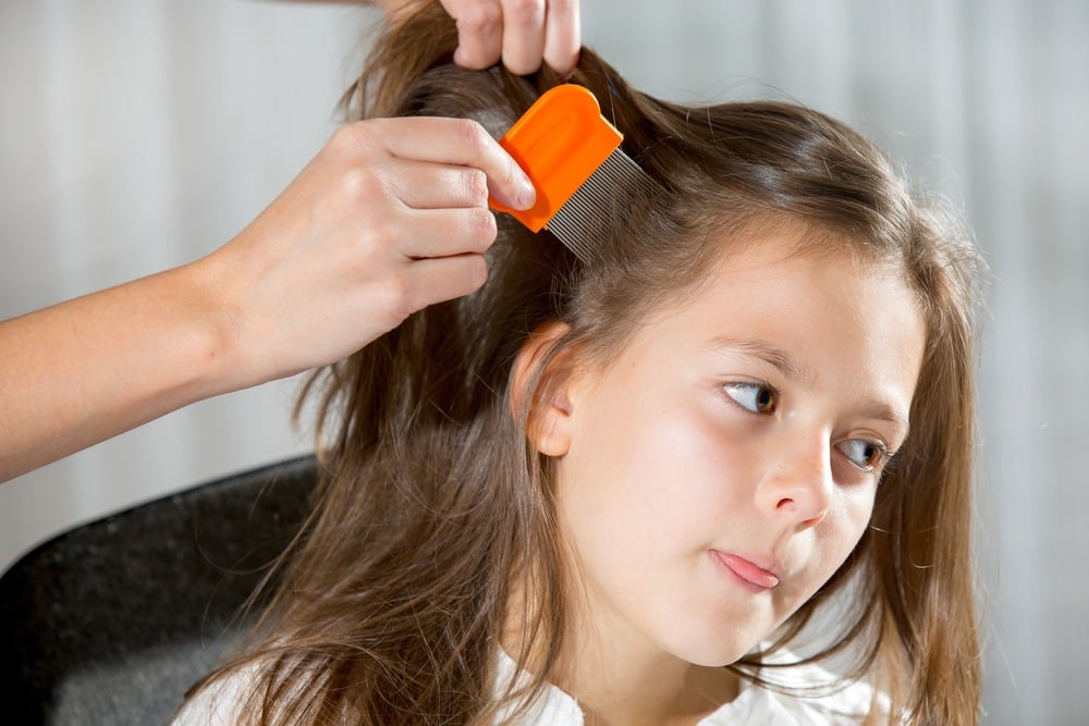 10 Natural Home Remedies to Get Rid of Lice