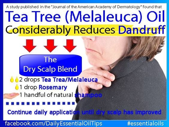dandruff tea tree oil essentialoilpro.net