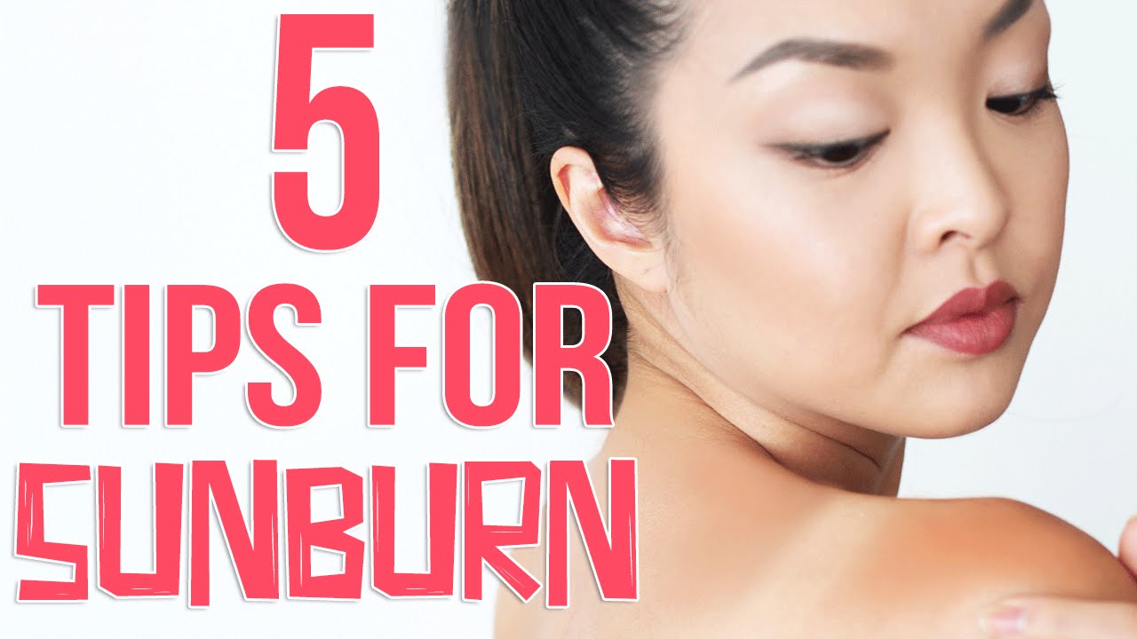 5 Effective Tips To Prevent And Get Rid Of Sunburn Fast