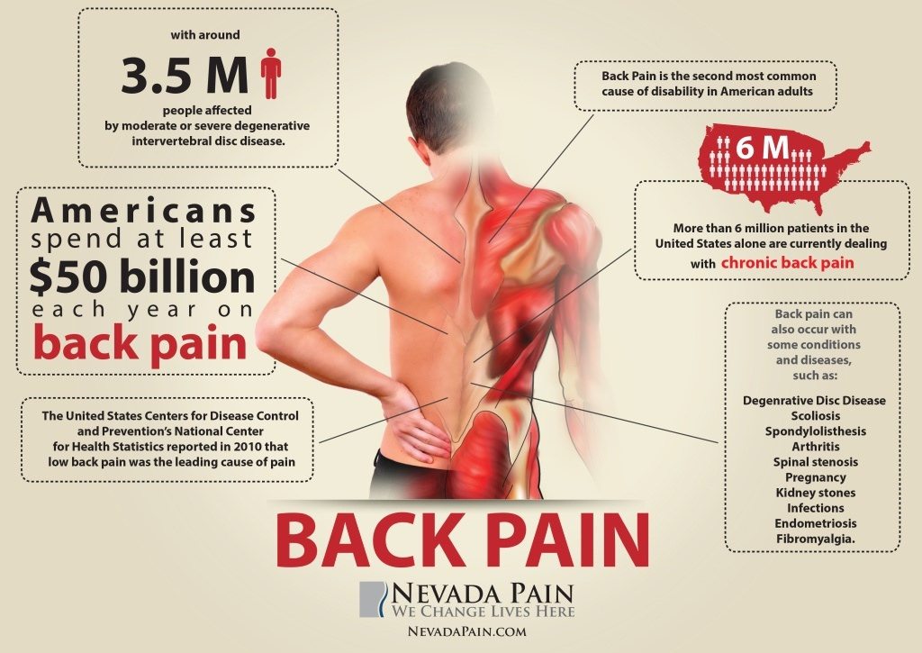 5-Minute Exercise To Effectively Reduce Your Back Pain