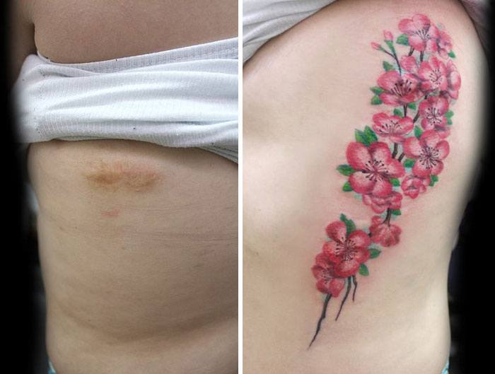 mastectomy-abuse-scar-women-free-tattoo-flavia-carvalho-daedra-art-brasil-3