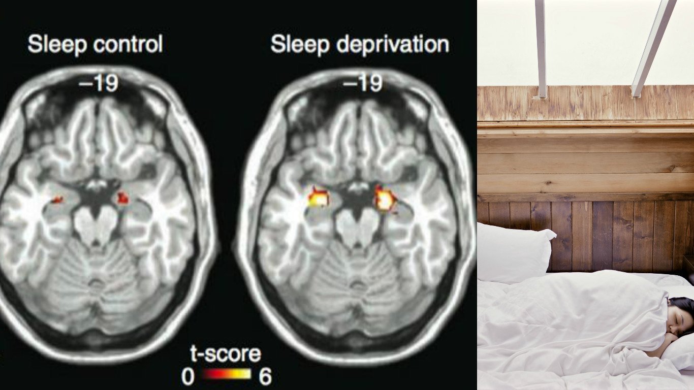 This Is What Happens To Your Brain When You Don&#8217;t Get Enough Sleep