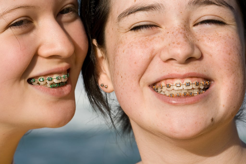 Helping Your Child Accept Their Braces