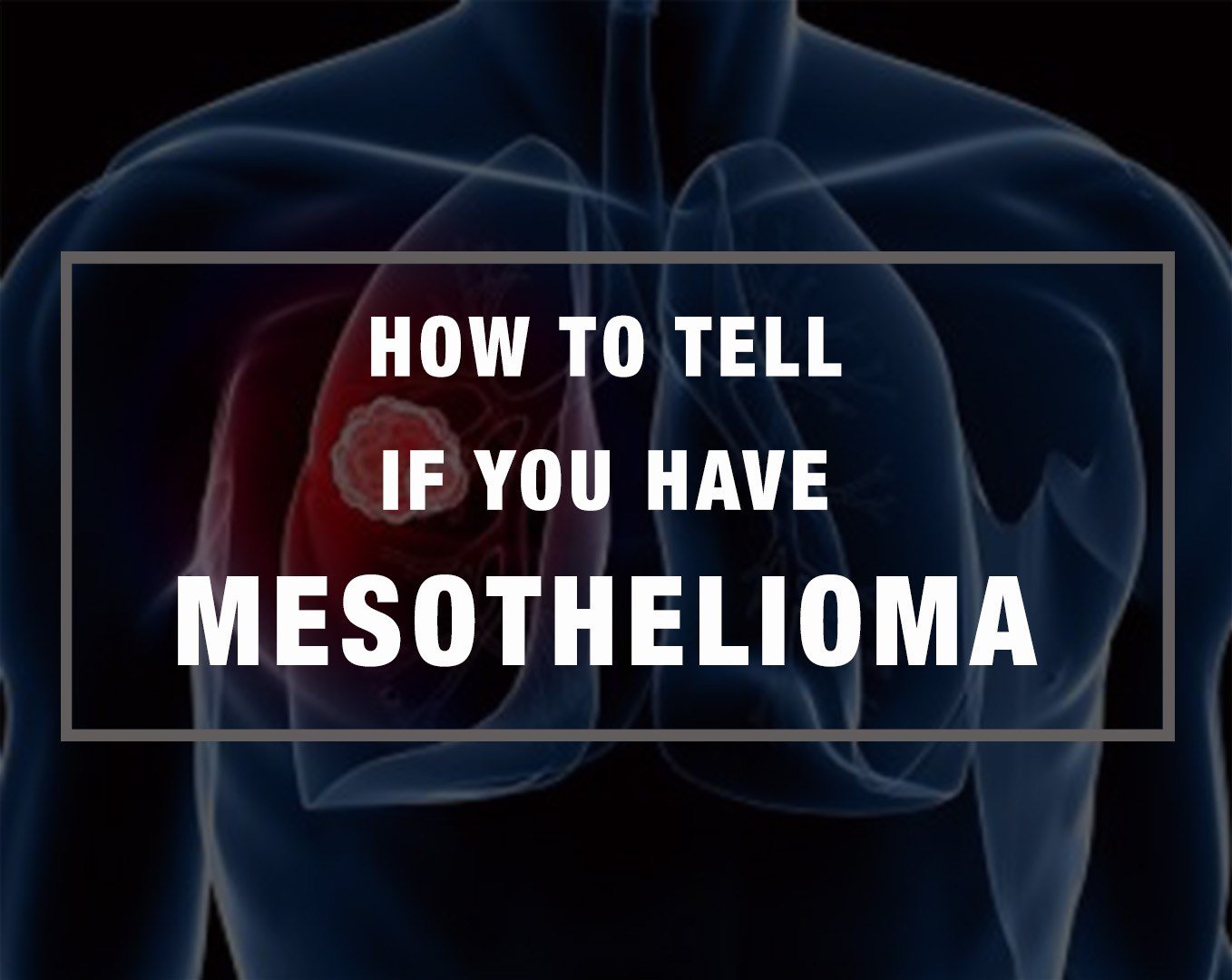 How to Tell if you Have Mesothelioma