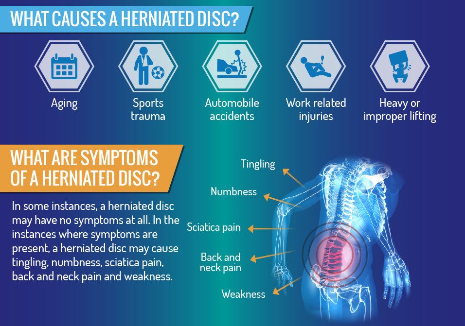Herniated Disc? Causes and Prevention Tips