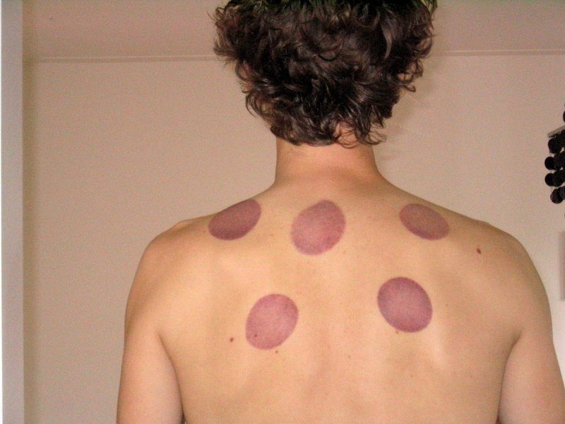 cupping_results