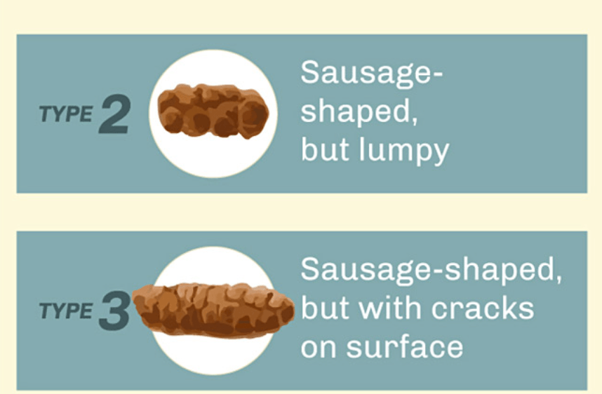 The Different Shapes of Poops And What They Mean To You
