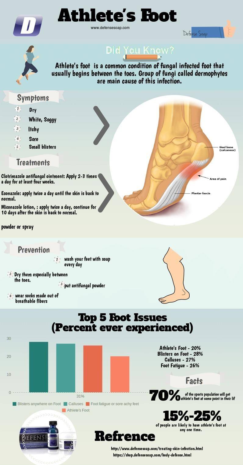 athletes-foot-infographic