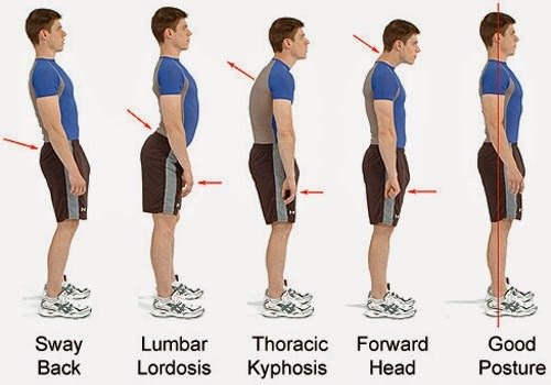 10 Graphs That Help You Improve Posture In No Time