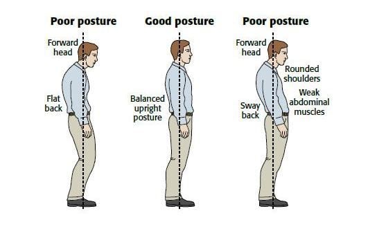 The Ultimate Exercises to Improve Posture (Simple and Effective)